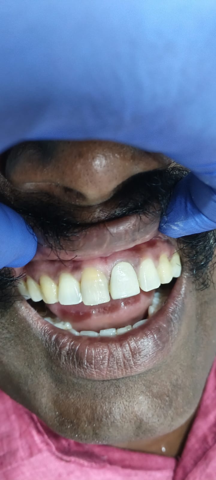 Happy Patient